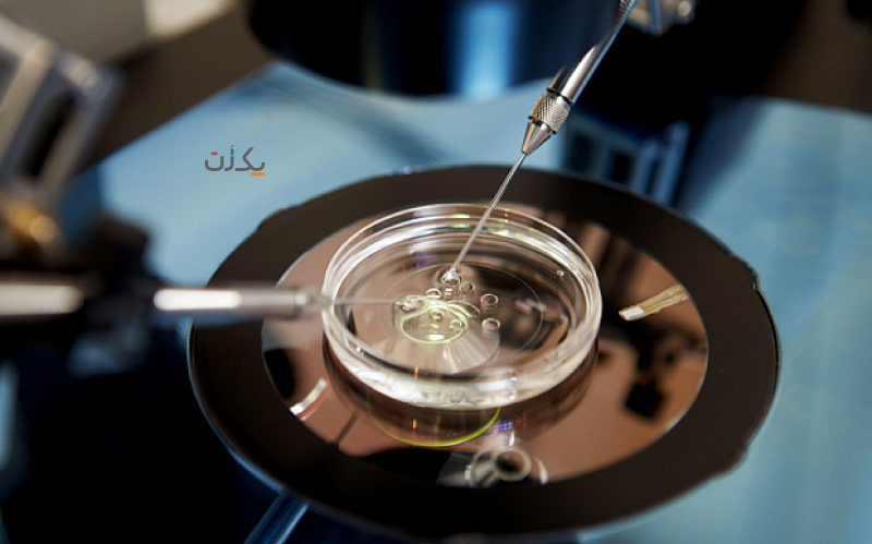 آزمایش آی وی اف چیست