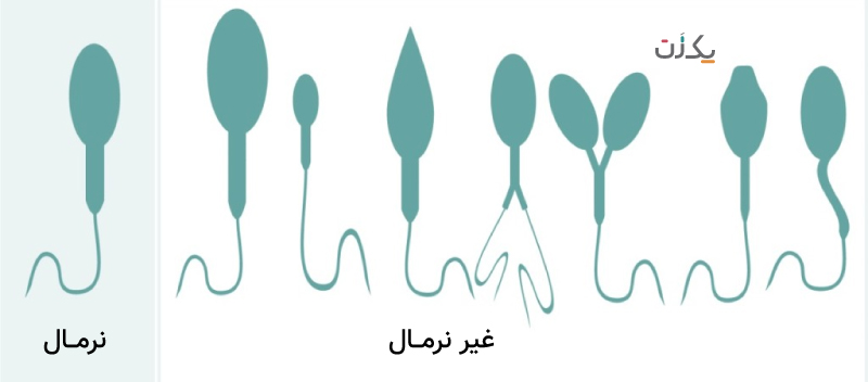 دانلود تفسیر آزمایش اسپرم