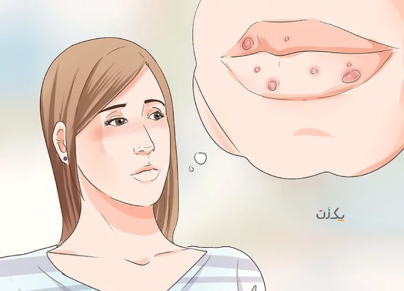 علائم سوزاک