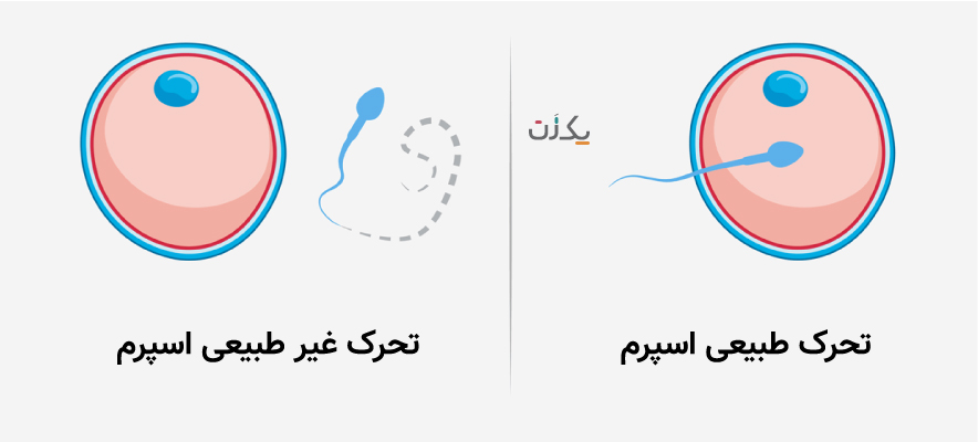 راه های افزایش کیفیت اسپرم