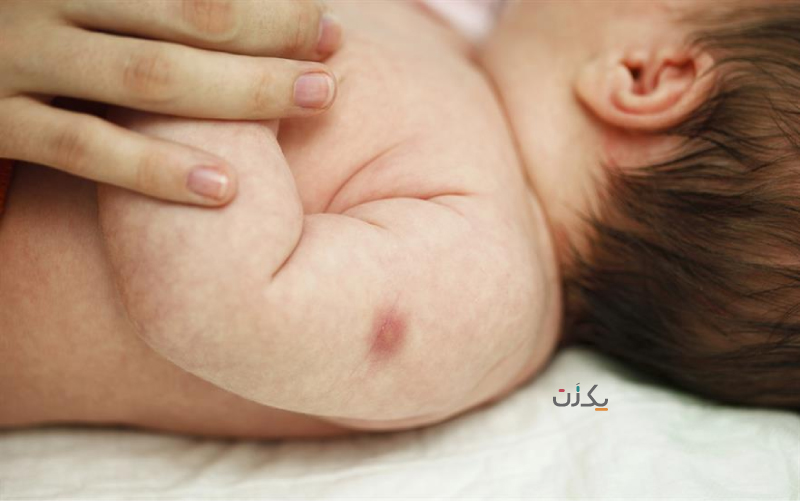 واکسن ب ث ژ در بدو تولد