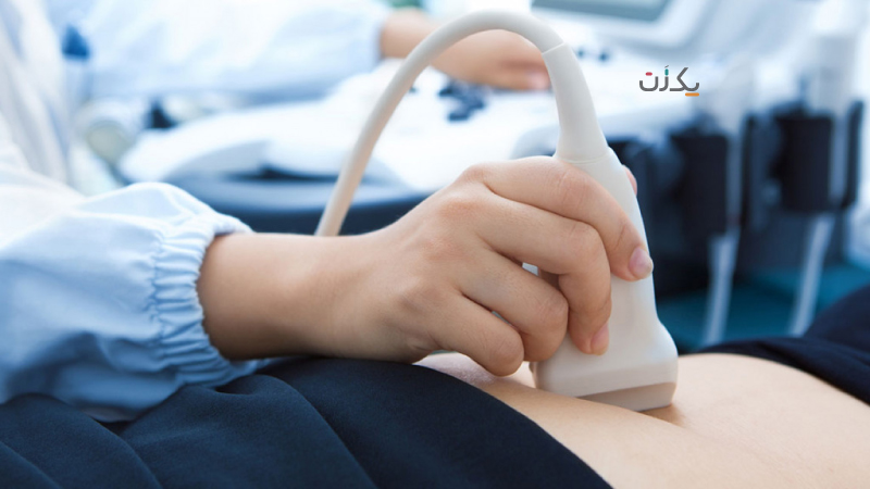 تشخیص بارداری پوچ