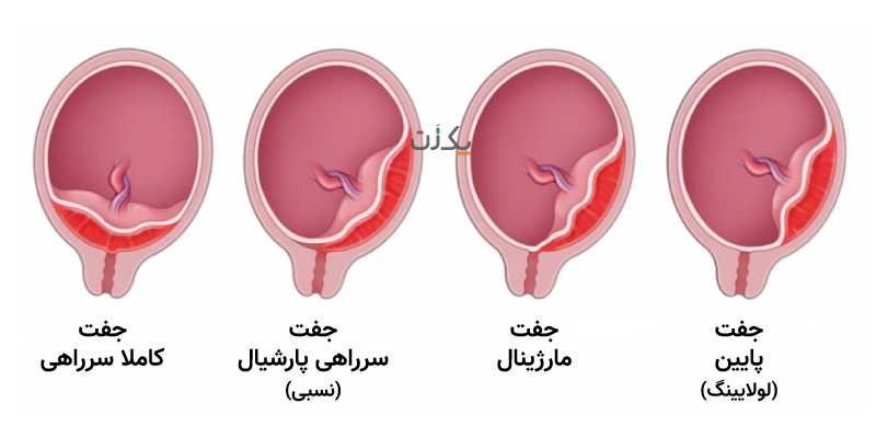 عکس جفت پایین