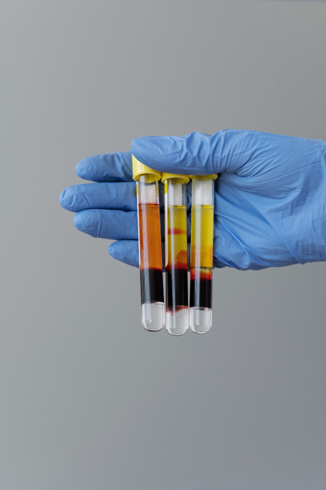 ضرورت انجام آزمایش های قبل از ازدواج