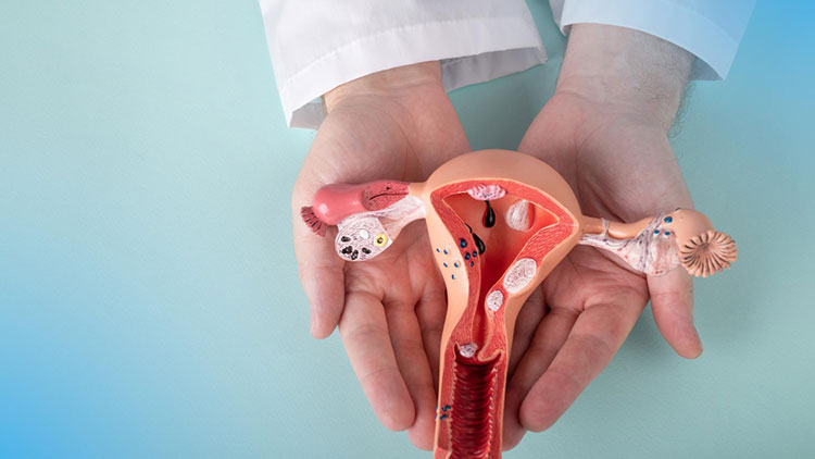 علائم سرطان دهانه رحم چیست؟