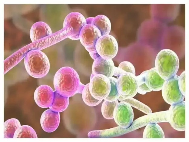 درباره عفونت قارچی واژن و درمان آن چه می دانید؟