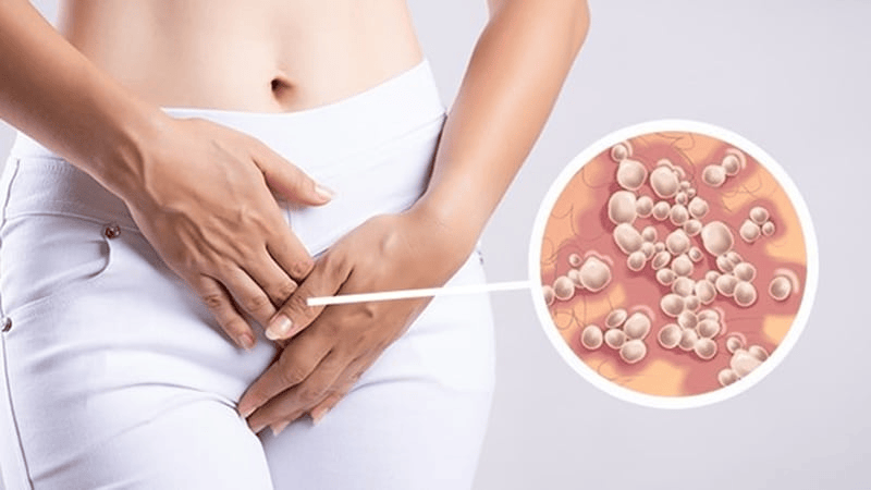 راه های انتقال تبخال تناسلی و درمان سریع آن