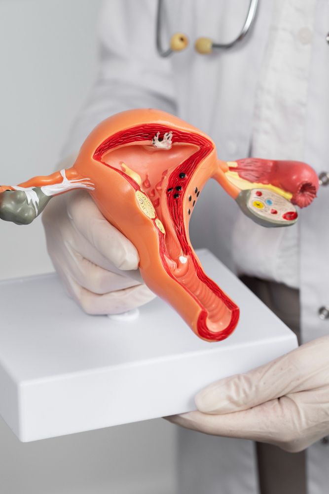  همه چيز درباره ى زخم دهانه رحم