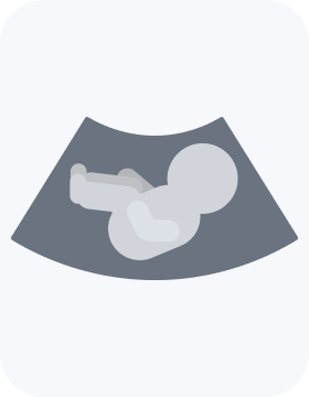 پیش بینی جنسیت جنین